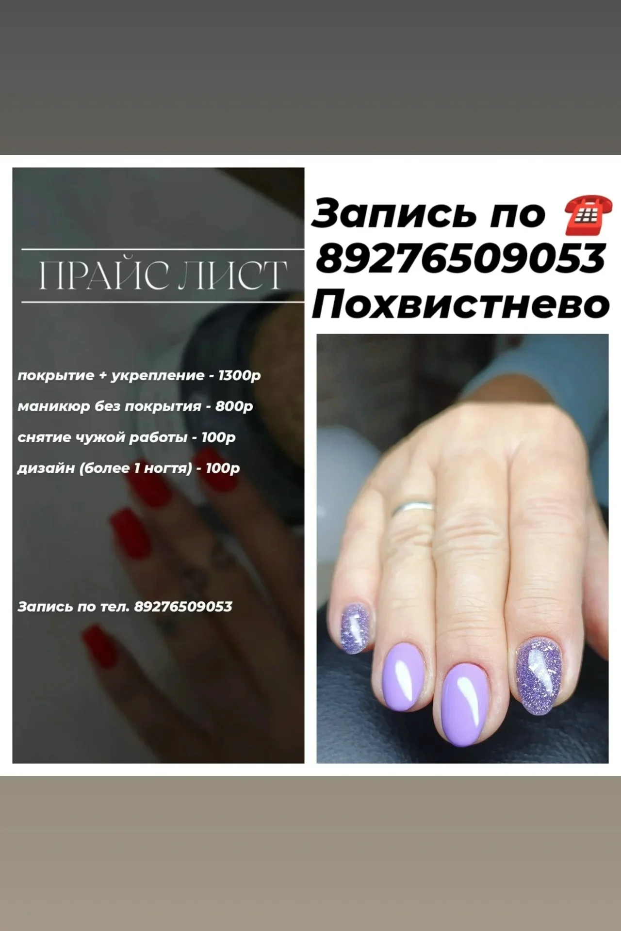 Ногти